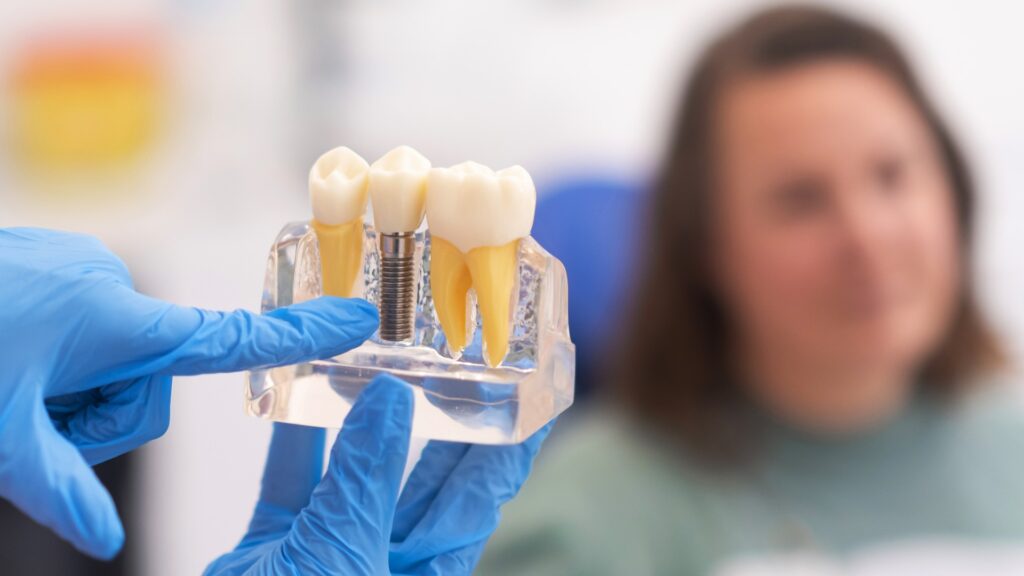 Zahnimplantate, Zahnarzt bespricht mit Patientin einen Behandlungsplan und hält ein Zahnimplantatmodell