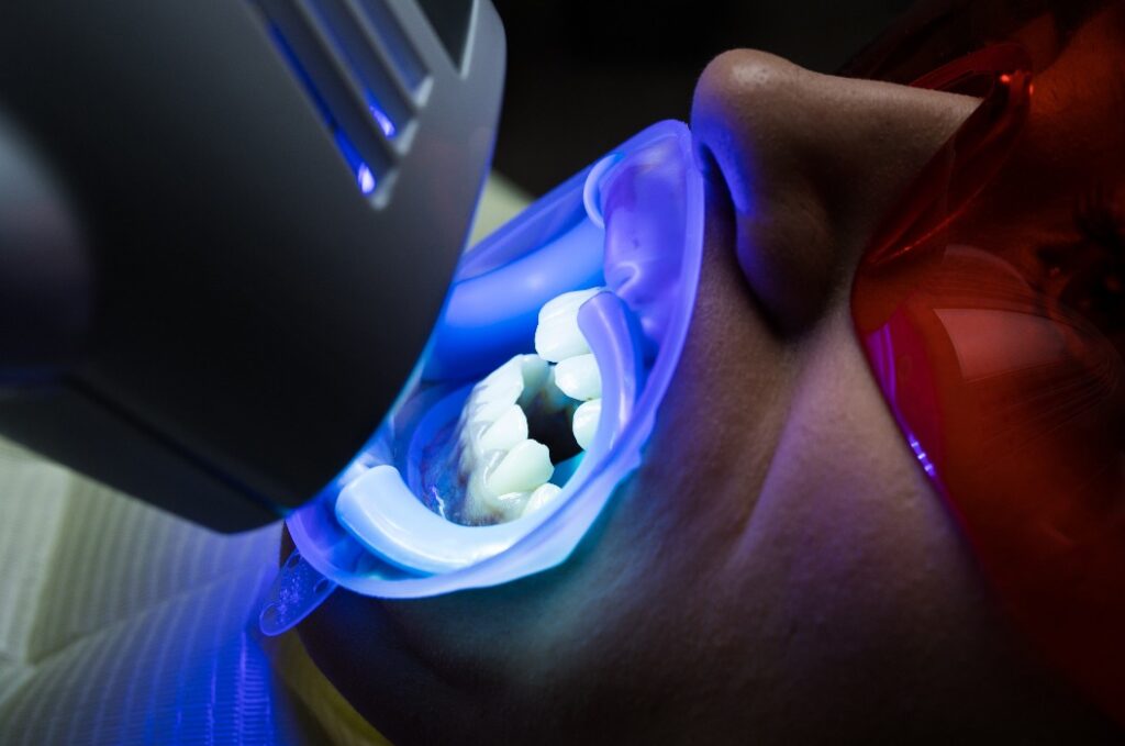 LED-Lampe für das Zahnbleaching